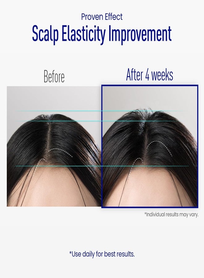 ViveLab Scalp Microneedle Serum – K-beauty Hair Growth & Scalp Treatment with Spioxyl™ 400 | Fills Hair Part Line, Strengthens Roots, Reduces Hair Thinning – 220,000 Microneedle Formula - Image 4